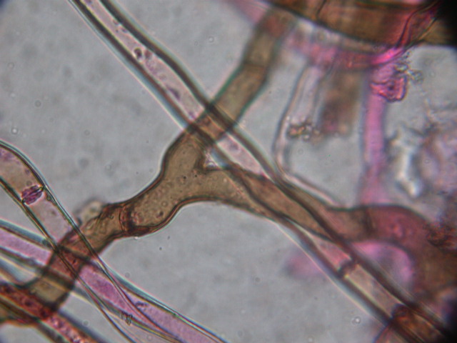 Geopora sumneriana ... in MICRO